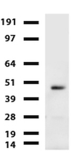CA12 Antibody in Western Blot (WB)