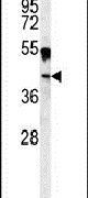 Carbonic Anhydrase XIV Antibody in Western Blot (WB)