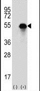Carbonic Anhydrase XIV Antibody in Western Blot (WB)