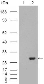 Carbonic Anhydrase I Monoclonal Antibody (9D6D7)