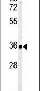 Carbonic Anhydrase IV Antibody in Western Blot (WB)