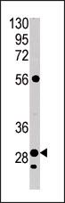CA9 Antibody in Western Blot (WB)