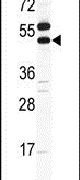 Carbonic Anhydrase IX Antibody in Western Blot (WB)