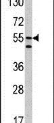 Carbonic Anhydrase IX Antibody in Western Blot (WB)