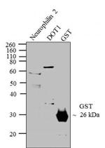 GST Tag Polyclonal Antibody