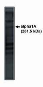 CaV2.1 Polyclonal Antibody