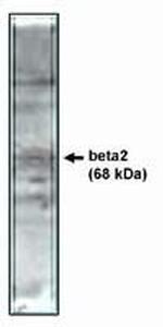CACNB2 Polyclonal Antibody