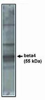 Calcium Channel beta-4 Polyclonal Antibody