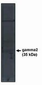 CACNB2 Polyclonal Antibody