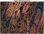 beta Catenin Antibody in Immunohistochemistry (Paraffin) (IHC (P))