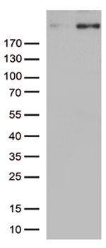 CAD Antibody in Western Blot (WB)