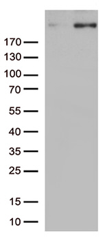CAD Antibody in Western Blot (WB)