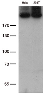 CAD Antibody in Western Blot (WB)