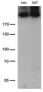 CAD Antibody in Western Blot (WB)
