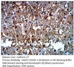 Cadherin 17 Antibody in Immunohistochemistry (IHC)