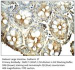 Cadherin 17 Antibody in Immunohistochemistry (IHC)