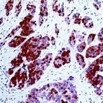 Calretinin Antibody in Immunohistochemistry (IHC)