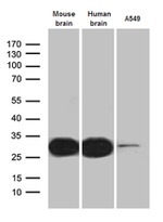 CALB2 Antibody in Western Blot (WB)