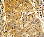 Caldesmon Antibody in Immunohistochemistry (IHC)