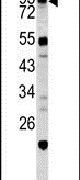 Caldesmon Antibody in Western Blot (WB)