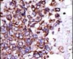CaMKI Antibody in Immunohistochemistry (IHC)
