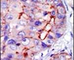 CAMK1D Antibody in Immunohistochemistry (IHC)