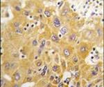 CAMK1D Antibody in Immunohistochemistry (IHC)