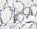 CAMK1D Antibody in Immunohistochemistry (Paraffin) (IHC (P))