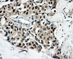 CAMK1D Antibody in Immunohistochemistry (Paraffin) (IHC (P))