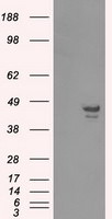 CAMK1D Antibody in Western Blot (WB)