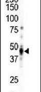 CAMK1D Antibody in Western Blot (WB)