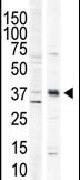 CaMKI Antibody in Western Blot (WB)