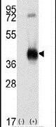 CaMKI Antibody in Western Blot (WB)