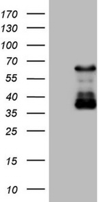 CAMK2B Antibody in Western Blot (WB)