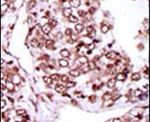CaMKII gamma Antibody in Immunohistochemistry (IHC)