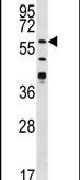 CaMKII gamma Antibody in Western Blot (WB)