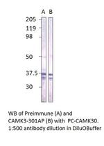 CaMKII gamma Polyclonal Antibody