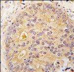 CaMKK beta Antibody in Immunohistochemistry (IHC)