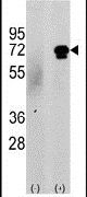 CaMKK beta Antibody in Western Blot (WB)