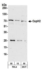 CAP-H2 Antibody in Western Blot (WB)