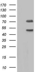 CAPN5 Antibody in Western Blot (WB)
