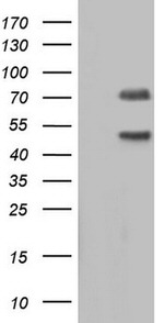 CAPN5 Antibody in Western Blot (WB)