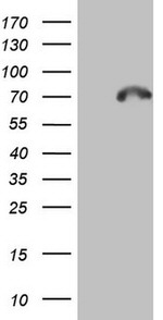 CAPN5 Antibody in Western Blot (WB)