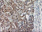 CAPN9 Antibody in Immunohistochemistry (Paraffin) (IHC (P))