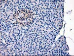 CAPN9 Antibody in Immunohistochemistry (Paraffin) (IHC (P))