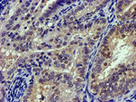 CAPN9 Antibody in Immunohistochemistry (Paraffin) (IHC (P))