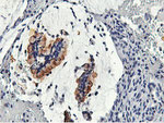 CAPN9 Antibody in Immunohistochemistry (Paraffin) (IHC (P))