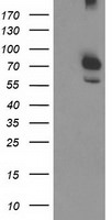 CAPN9 Antibody in Western Blot (WB)