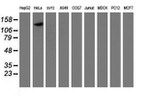 CAPN9 Antibody in Western Blot (WB)