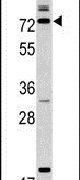 Calpain 9 Antibody in Western Blot (WB)
